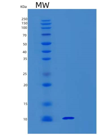 Recombinant Human Synaptobrevin 1 Protein