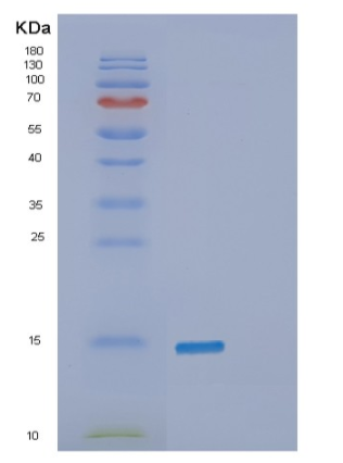 Recombinant Human β-Synuclein Protein