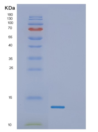 Recombinant Human γ-Synuclein Protein
