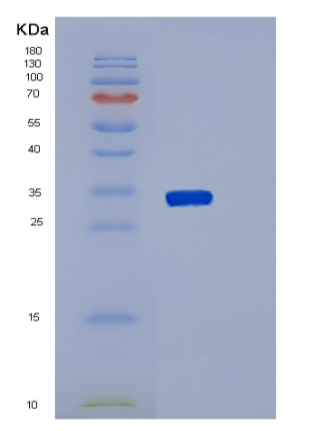 Recombinant Human SYT1 Protein