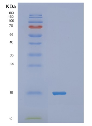 Recombinant Human TAC1 Protein