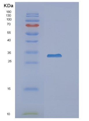 Recombinant Human TACSTD2 Protein