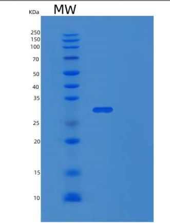 Recombinant Human TAF15 Protein