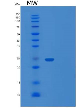 Recombinant Human TAGLN2 Protein
