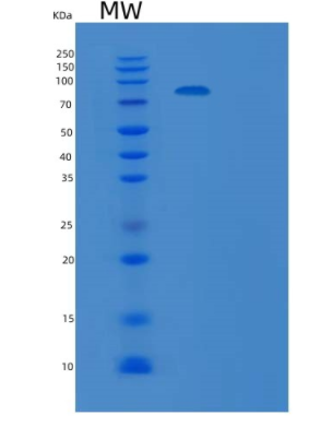 Recombinant Human TARS Protein