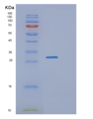 Recombinant Human TBCB Protein