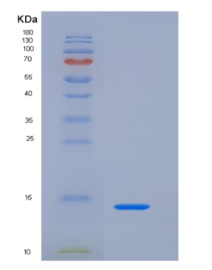 Recombinant Trefoil Factor 1 (TFF1)