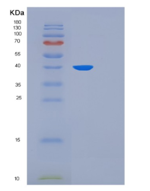 Recombinant Human THPO Protein