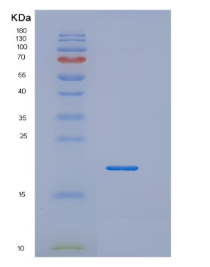 Recombinant Tumor Necrosis Factor Beta (TNFb)
