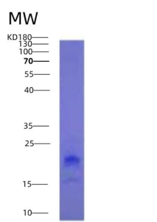 Eukaryotic Tumor Necrosis Factor Ligand Superfamily, Member 18 (TNFSF18)