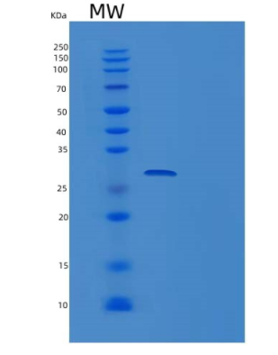 Recombinant Human TREX2 Protein