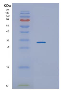 Recombinant Human TWF1 Protein