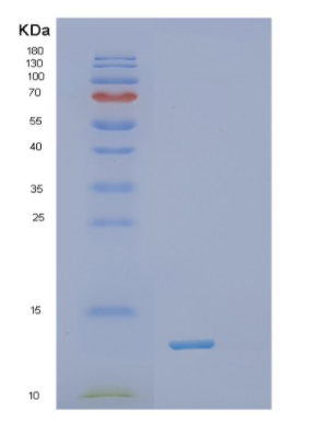 Recombinant Human TXN Protein