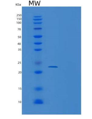 Recombinant Human UBE2T Protein