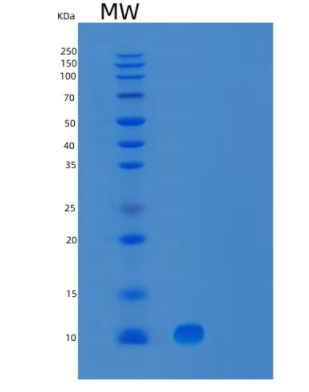 Recombinant Human UBL5 Protein