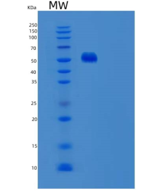 Recombinant Human UMPS Protein