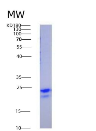 Eukaryotic Vascular Endothelial Growth Factor 165 (VEGF165)