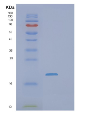 Recombinant Human VEGF165 Protein