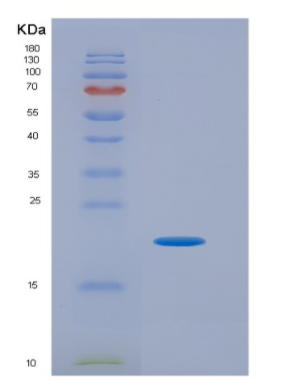 Eukaryotic Vascular Endothelial Growth Factor C (VEGFC)
