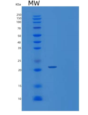 Recombinant Human Visinin-like protein-1