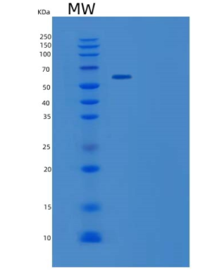 Recombinant Human WHSC2 Protein