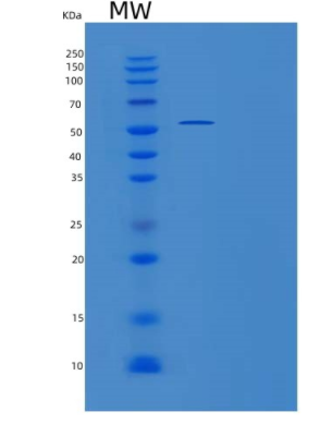 Recombinant Human WRS (Tryptophanyl-tRNA synthetase) Protein