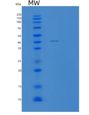 Recombinant Human XAB1 Protein