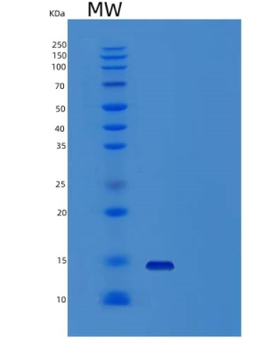 Recombinant Human β-2-Microglobulin/B2M Protein(N-6His)