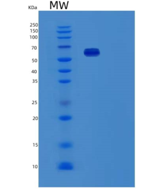 Recombinant Human Fibronectin Fragment/RetroNectin/NovoNectin Protein
