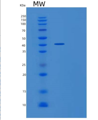 Recombinant Human TRAIL R2/TNFRSF10B/DR5/CD262 Protein(C-Fc-6His)