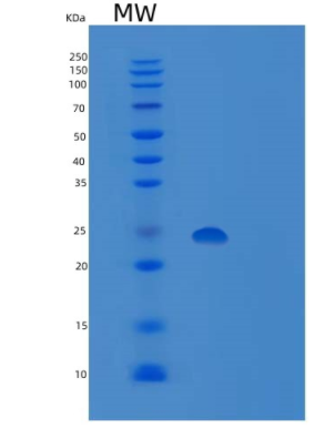 Recombinant Human Peroxiredoxin-1/PRDX1 Protein(N, C-6His)