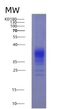 Eukaryotic Interferon Gamma (IFNg)