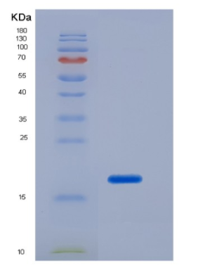 Eukaryotic Interleukin 2 (IL2)