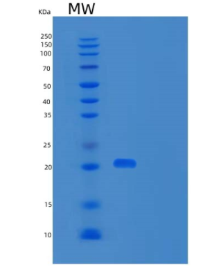 Recombinant Human Ferritin Heavy Chain/FTH Protein