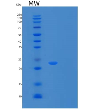 Recombinant Human Ferritin Heavy Chain/FTH Protein(N-6His)
