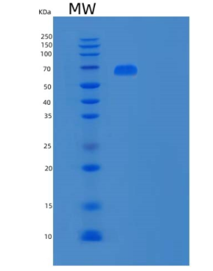 Recombinant Human Polymeric Immunoglobulin Receptor Protein