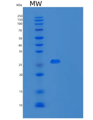 Recombinant Human Microfibril-Associated Glycoprotein 4/MFAP4 Protein(C-6His)