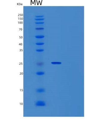 Recombinant Mouse Interferon γ Receptor 1/IFN-γ R1/CD119 Protein(C-6His)