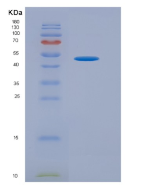 Eukaryotic High Mobility Group Protein 1 (HMGB1)