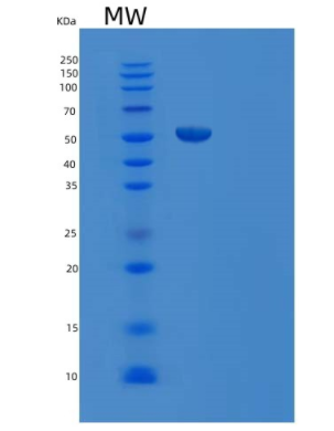 Recombinant Human V-Set and Ig Domain-Containing Protein 4/VSIG4/CRIg Protein(C-Fc)