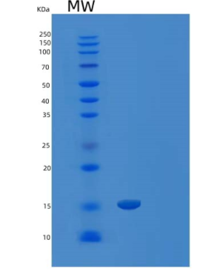 Recombinant Human LAIR-2/CD306 Protein(C-6His)