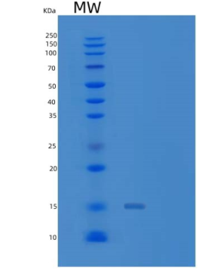 Recombinant Human Galectin-1 / LGALS1 Protein