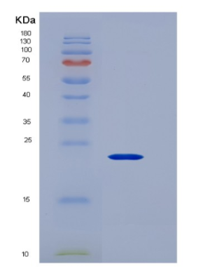 Recombinant Human CD147 / EMMPRIN / Basigin Protein (His tag)