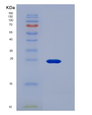 Recombinant Human CD16a / FCGR3A Protein (176 Phe, His & AVI tag)