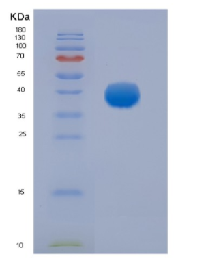 Eukaryotic Fc Fragment Of IgG Low Affinity IIIa Receptor (FcgR3A)