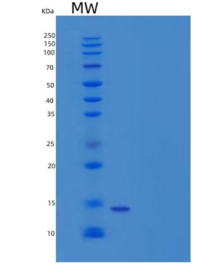 Recombinant Human Cystatin M/CST6 Protein(C-6His)