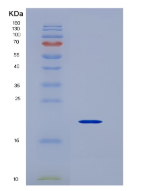 Eukaryotic Vascular Endothelial Growth Factor D (VEGFD)
