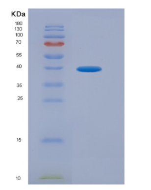 Eukaryotic Cluster Of Differentiation 200 (CD200).