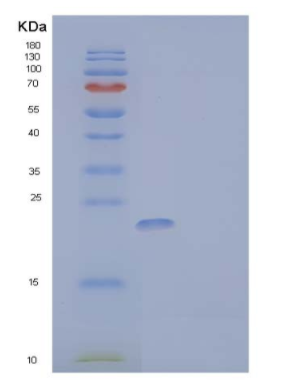 Recombinant Human Parathyroid hormone 1 receptor Protein