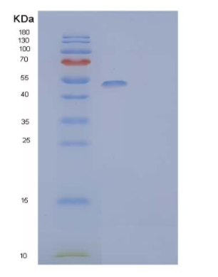 Recombinant Mouse Natural Cytotoxicity Triggering Receptor 1/NCR1Protein (C-6His)